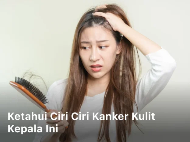 Ketahui Ciri Ciri Kanker Kulit Kepala ini