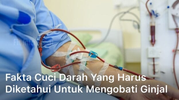 Fakta Cuci Darah yang Harus Diketahui untuk Mengobati Ginjal