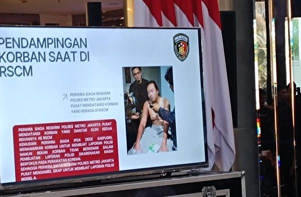 polda metro jaya gelar konferensi pers update kasus penyiraman air keras ke aktivis kontras andrie yunus rizkydetikcom 1773639779972 169